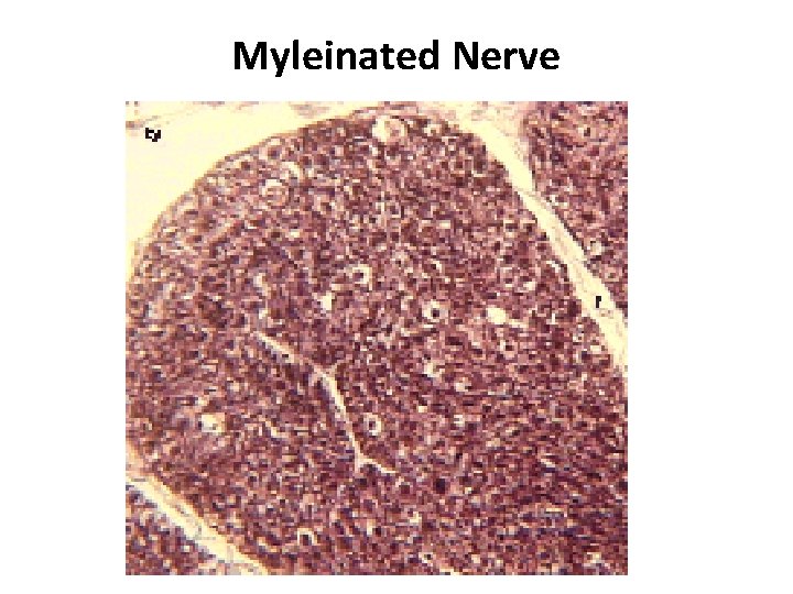 Myleinated Nerve 