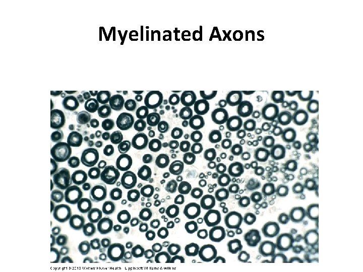 Myelinated Axons 