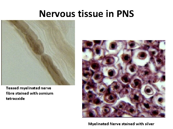 Nervous tissue in PNS Teased myelinated nerve fibre stained with osmium tetraoxide Myelinated Nerve