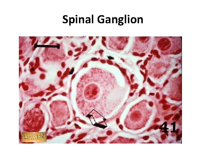 Spinal Ganglion 