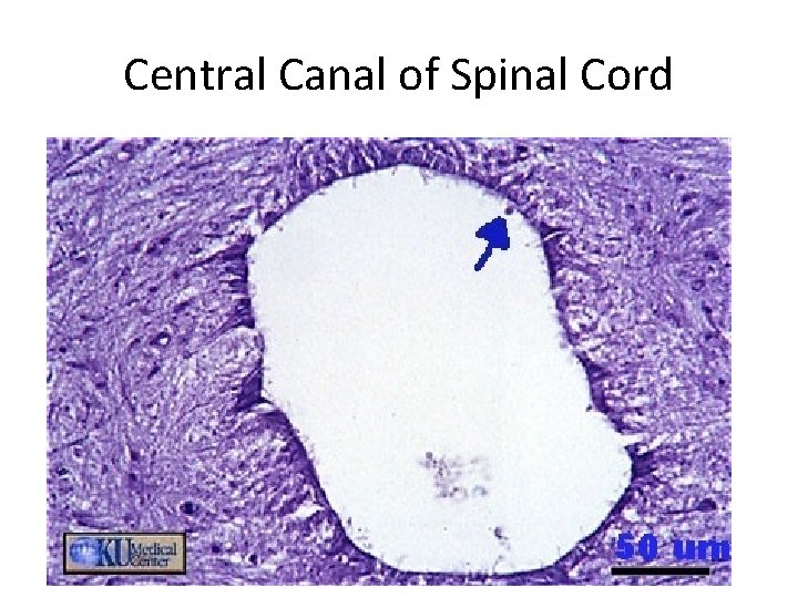 Central Canal of Spinal Cord 