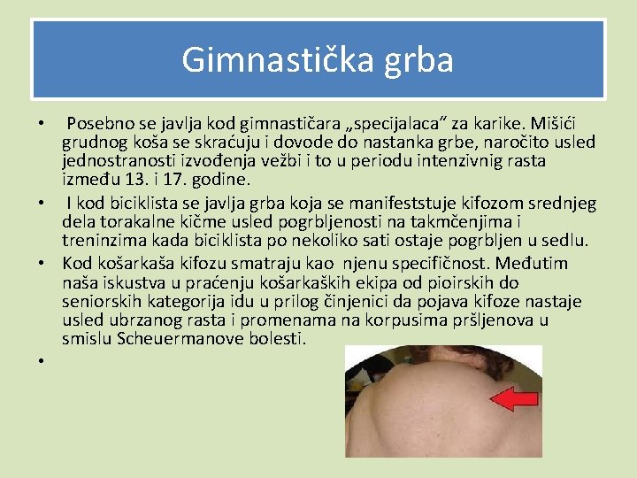 Gimnastička grba Posebno se javlja kod gimnastičara „specijalaca“ za karike. Mišići grudnog koša se