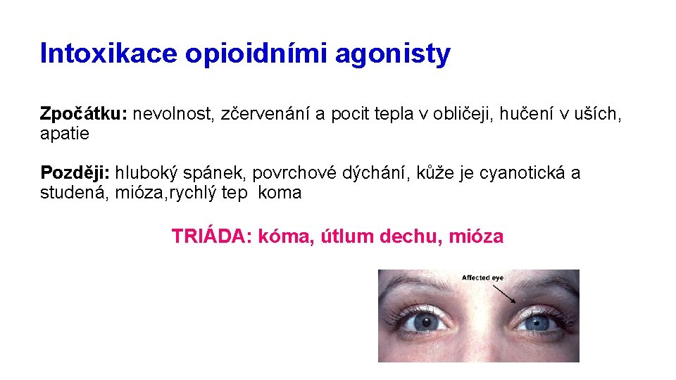 Intoxikace opioidními agonisty Zpočátku: nevolnost, zčervenání a pocit tepla v obličeji, hučení v uších,