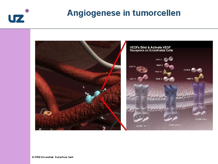 1 0 Angiogenese in tumorcellen VEGFR-1 © 2008 Universitair Ziekenhuis Gent VEGFR-2 VEGFR-3 10