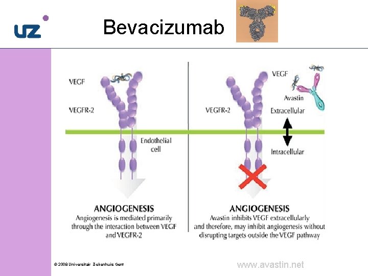 Bevacizumab to VEGF) © 2008 Universitair Ziekenhuis Gent www. avastin. net 14 