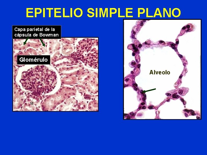 EPITELIO SIMPLE PLANO Capa parietal de la cápsula de Bowman Glomérulo Alveolo EPITELIO SIMPLE PLANO Capa parietal de la cápsula de Bowman Glomérulo Alveolo