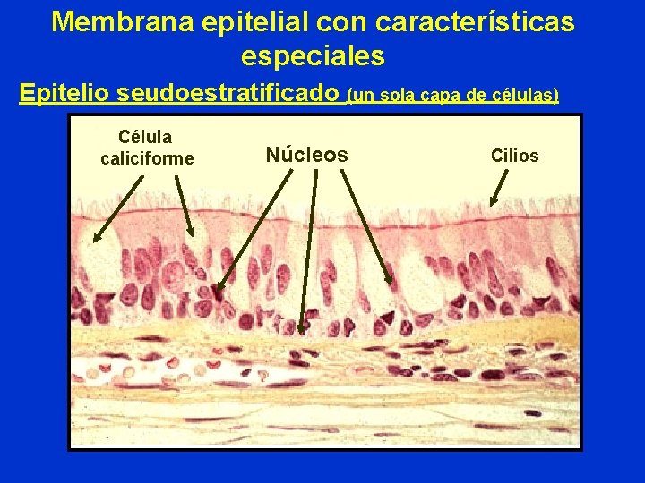 Membrana epitelial con características especiales Epitelio seudoestratificado (un sola capa de células) Célula caliciforme Membrana epitelial con características especiales Epitelio seudoestratificado (un sola capa de células) Célula caliciforme
