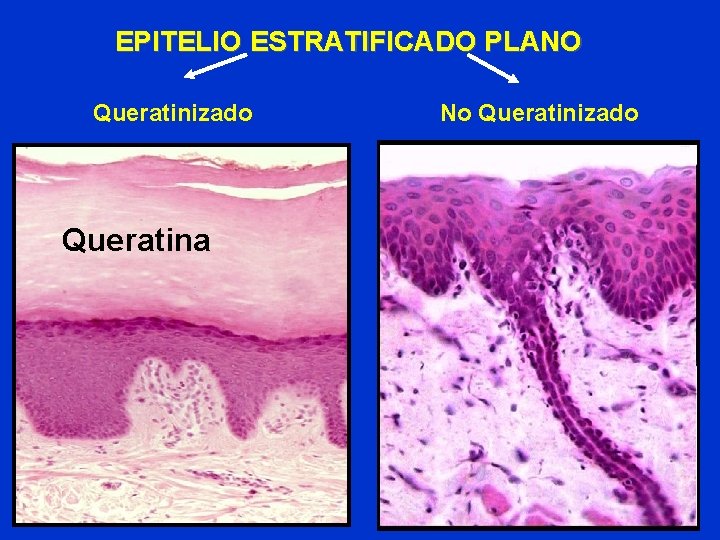 EPITELIO ESTRATIFICADO PLANO Queratinizado Queratina No Queratinizado EPITELIO ESTRATIFICADO PLANO Queratinizado Queratina No Queratinizado
