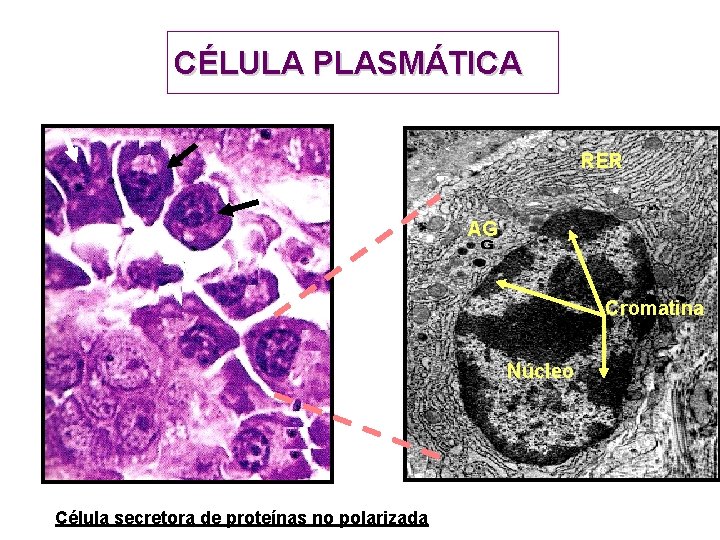 CÉLULA PLASMÁTICA RER AG Cromatina Núcleo Célula secretora de proteínas no polarizada CÉLULA PLASMÁTICA RER AG Cromatina Núcleo Célula secretora de proteínas no polarizada