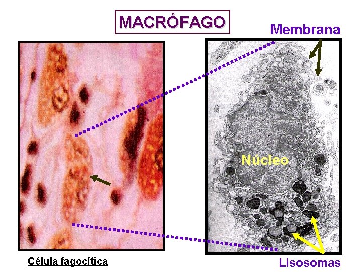MACRÓFAGO Membrana Núcleo Célula fagocítica Lisosomas MACRÓFAGO Membrana Núcleo Célula fagocítica Lisosomas