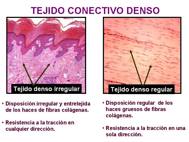 TEJIDO CONECTIVO DENSO Tejido denso irregular • Disposición irregular y entretejida de los haces TEJIDO CONECTIVO DENSO Tejido denso irregular • Disposición irregular y entretejida de los haces