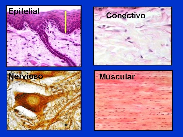 Epitelial Nervioso Conectivo Muscular Epitelial Nervioso Conectivo Muscular