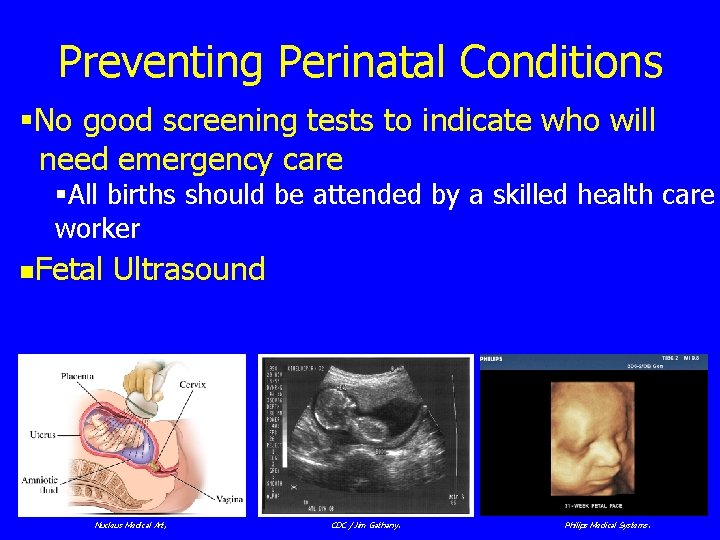 Preventing Perinatal Conditions §No good screening tests to indicate who will need emergency care