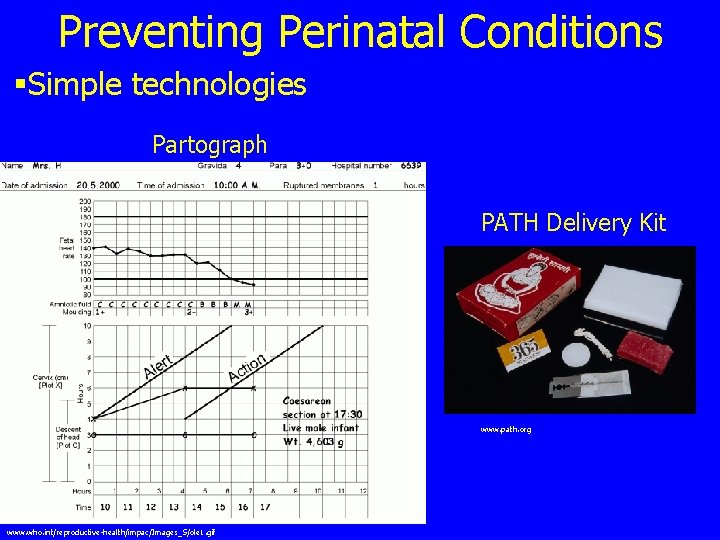 Preventing Perinatal Conditions §Simple technologies Partograph PATH Delivery Kit www. path. org www. who.
