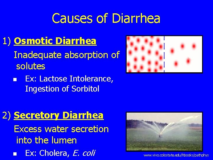 Causes of Diarrhea 1) Osmotic Diarrhea Inadequate absorption of solutes n Ex: Lactose Intolerance,