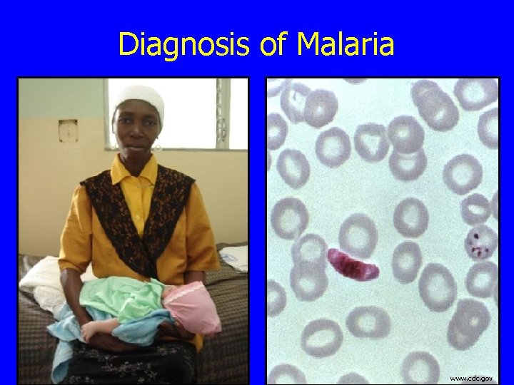 Diagnosis of Malaria www. cdc. gov 