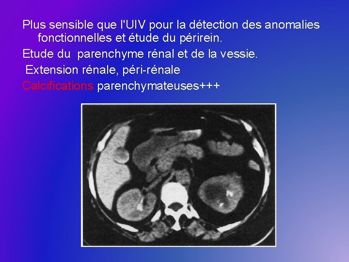 Plus sensible que l'UIV pour la détection des anomalies fonctionnelles et étude du périrein.