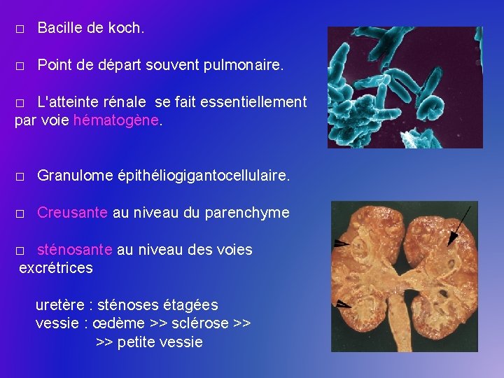 � Bacille de koch. � Point de départ souvent pulmonaire. L'atteinte rénale se fait