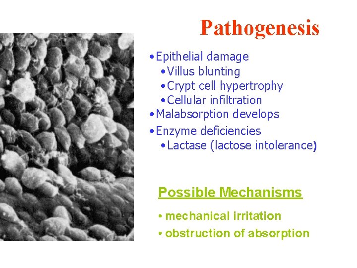 Pathogenesis • Epithelial damage • Villus blunting • Crypt cell hypertrophy • Cellular infiltration