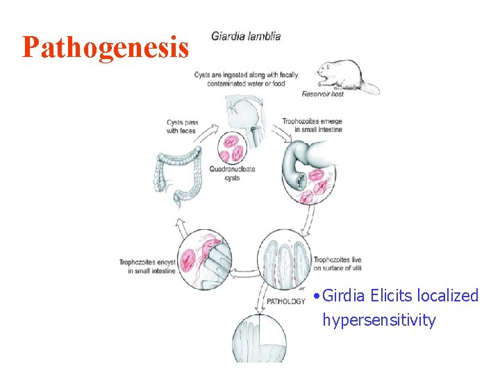 Pathogenesis • Girdia Elicits localized hypersensitivity 