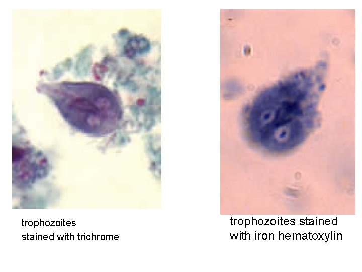 trophozoites stained with trichrome trophozoites stained with iron hematoxylin 