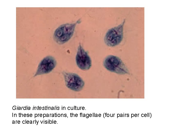 Giardia intestinalis in culture. In these preparations, the flagellae (four pairs per cell) are