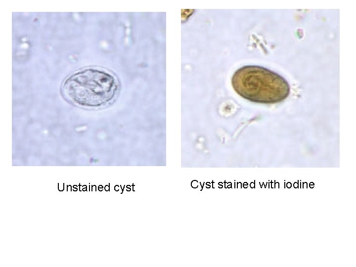 Unstained cyst Cyst stained with iodine 