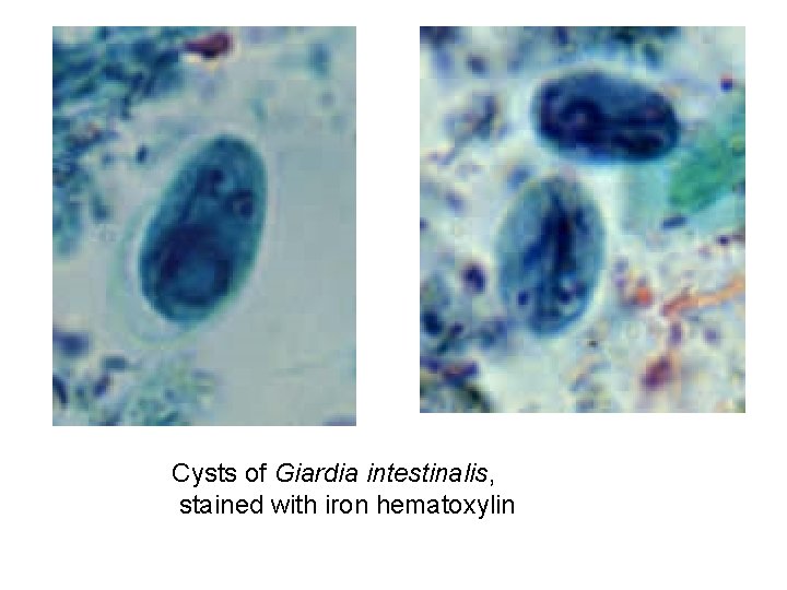 Cysts of Giardia intestinalis, stained with iron hematoxylin 