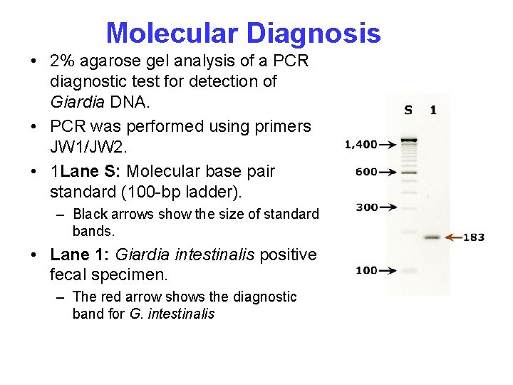 Molecular Diagnosis • 2% agarose gel analysis of a PCR diagnostic test for detection