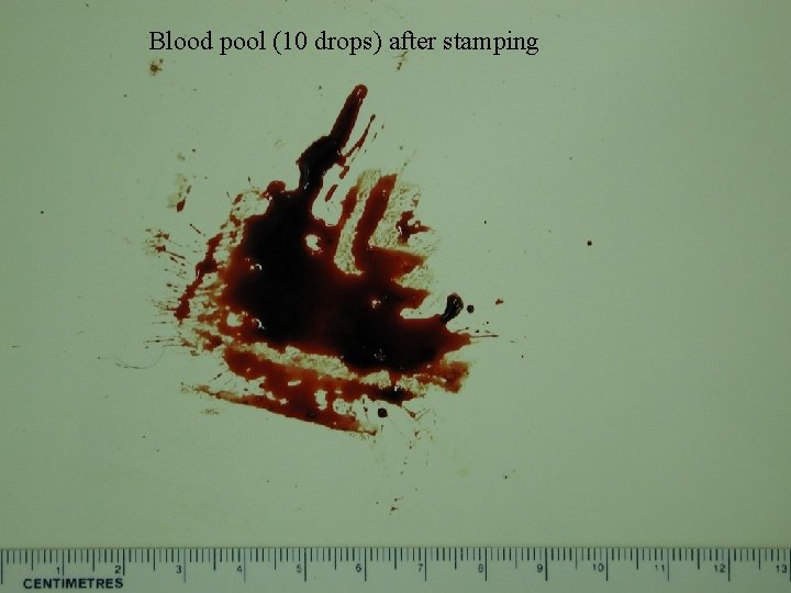 Blood pool (10 drops) after stamping Stamp 2 