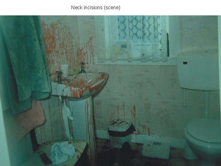 Neck incisions (scene) 