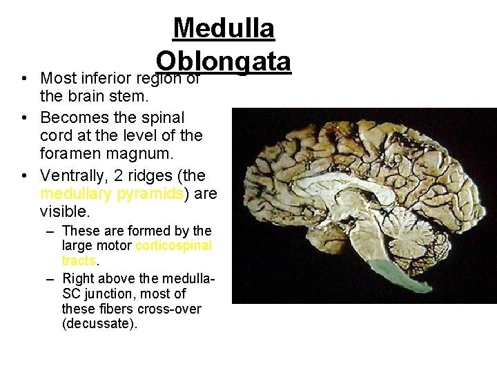  • Medulla Oblongata Most inferior region of the brain stem. • Becomes the