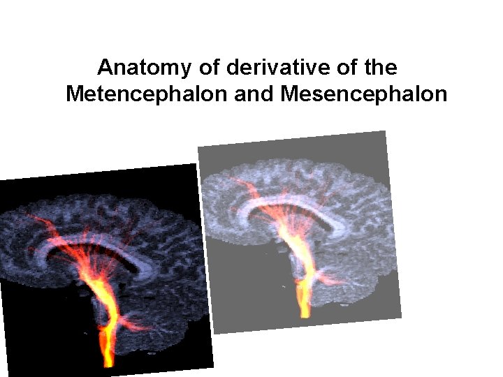 Anatomy of derivative of the Metencephalon and Mesencephalon 