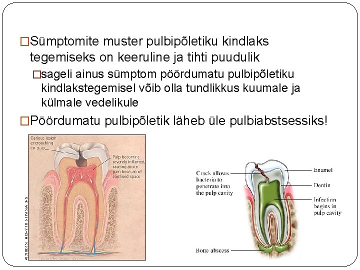 �Sümptomite muster pulbipõletiku kindlaks tegemiseks on keeruline ja tihti puudulik �sageli ainus sümptom pöördumatu