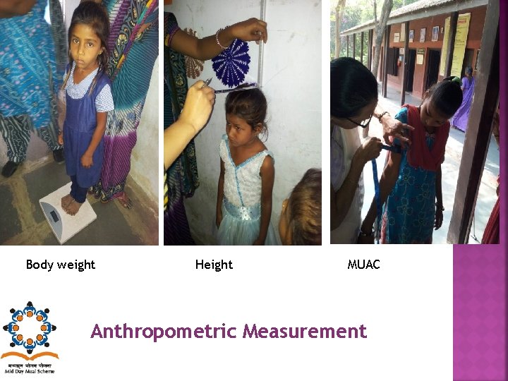 Body weight Height MUAC Anthropometric Measurement 