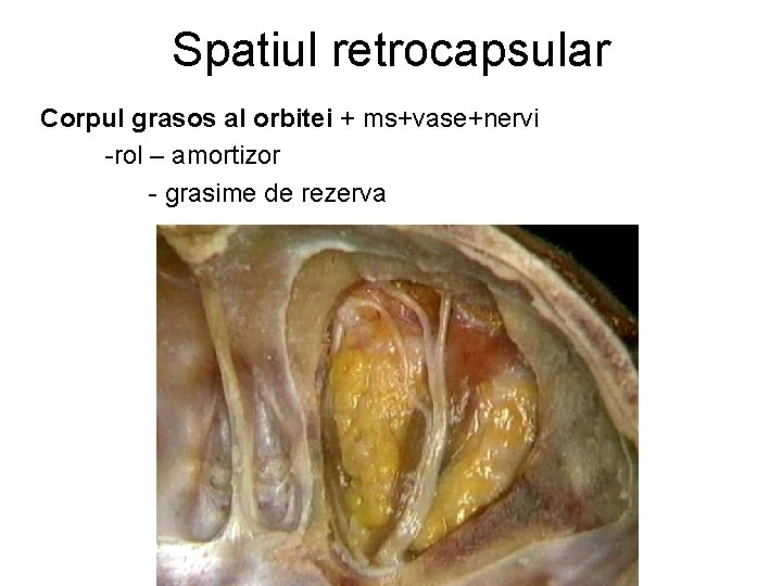 Spatiul retrocapsular Corpul grasos al orbitei + ms+vase+nervi -rol – amortizor - grasime de