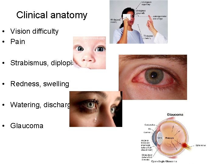 Clinical anatomy • Vision difficulty • Pain • Strabismus, diplopia • Redness, swelling •