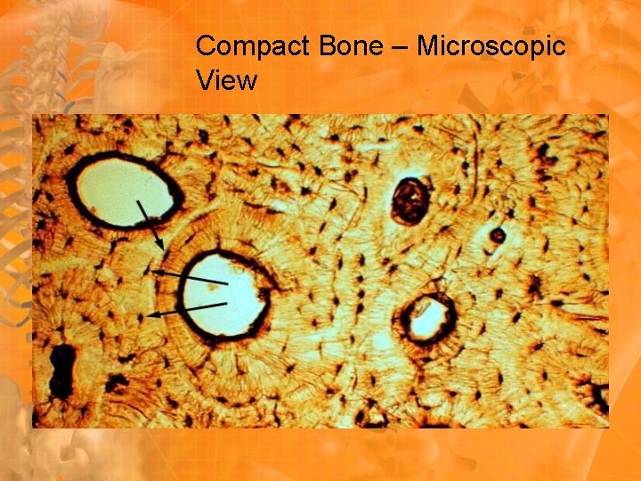 Compact Bone – Microscopic View 