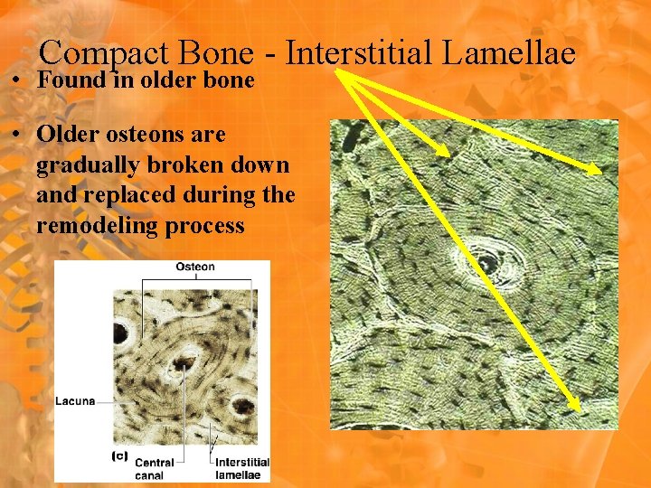 Compact Bone - Interstitial Lamellae • Found in older bone • Older osteons are