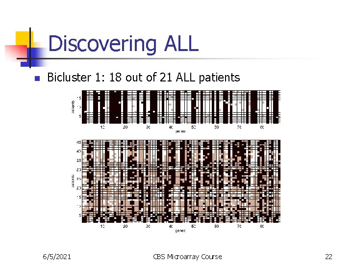 Discovering ALL n Bicluster 1: 18 out of 21 ALL patients 6/5/2021 CBS Microarray