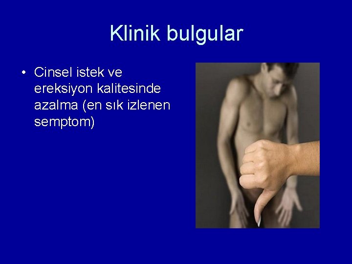 Klinik bulgular • Cinsel istek ve ereksiyon kalitesinde azalma (en sık izlenen semptom) 