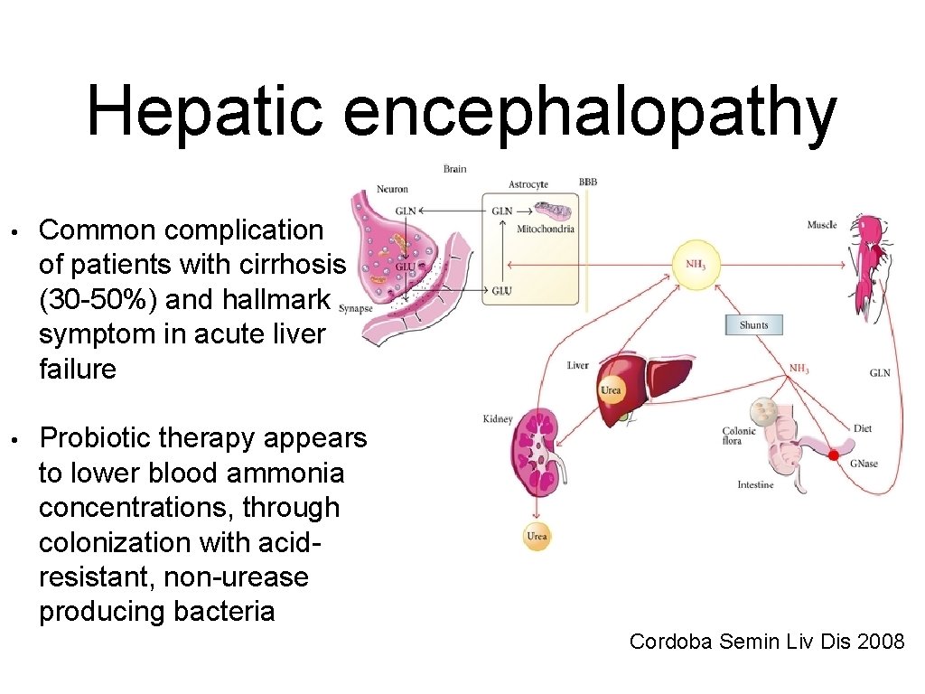 Hepatic encephalopathy • Common complication of patients with cirrhosis (30 -50%) and hallmark symptom