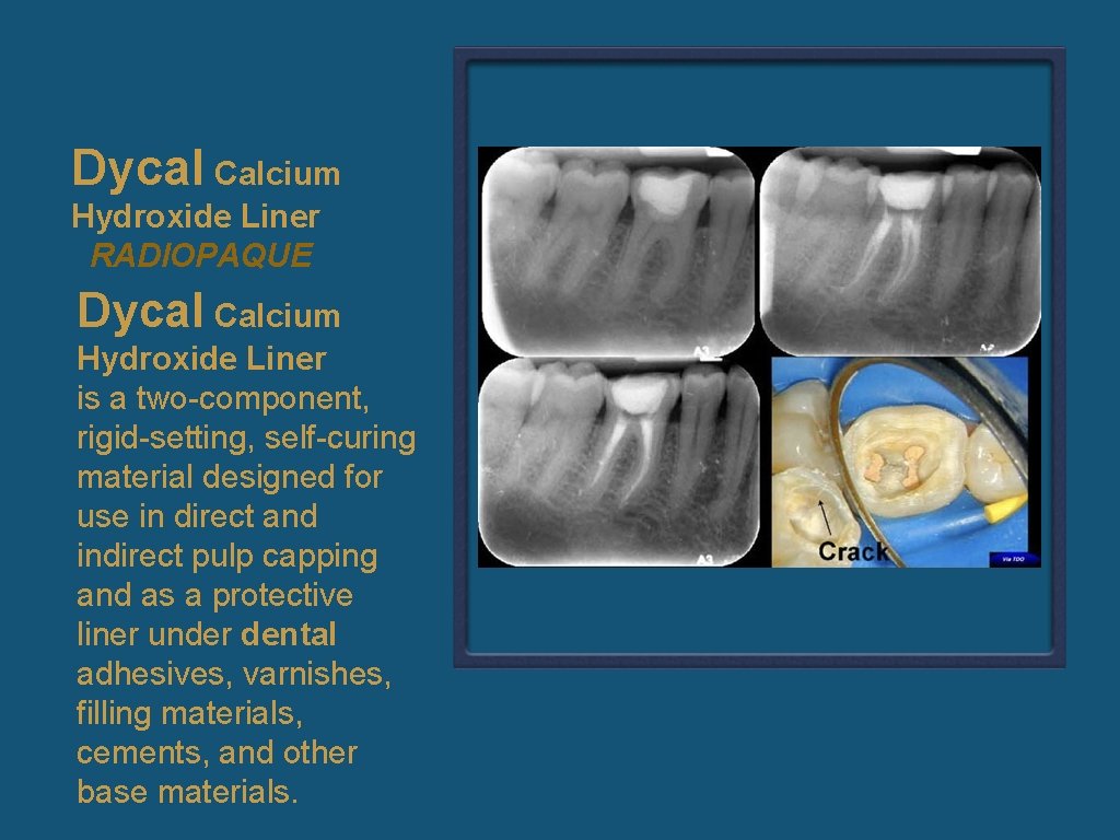 Dycal Calcium Hydroxide Liner RADIOPAQUE Dycal Calcium Hydroxide Liner is a two-component, rigid-setting, self-curing