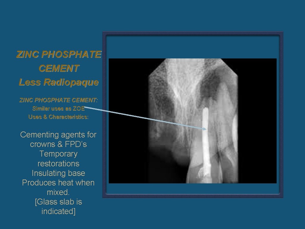 ZINC PHOSPHATE CEMENT Less Radiopaque ZINC PHOSPHATE CEMENT: Similar uses as ZOE Uses &