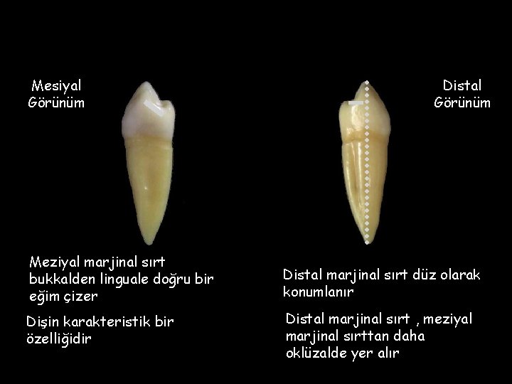 Mesiyal Görünüm Distal Görünüm Meziyal marjinal sırt bukkalden linguale doğru bir eğim çizer Distal