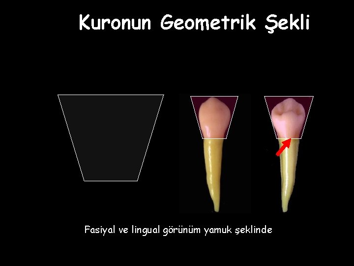 Kuronun Geometrik Şekli Fasiyal ve lingual görünüm yamuk şeklinde 