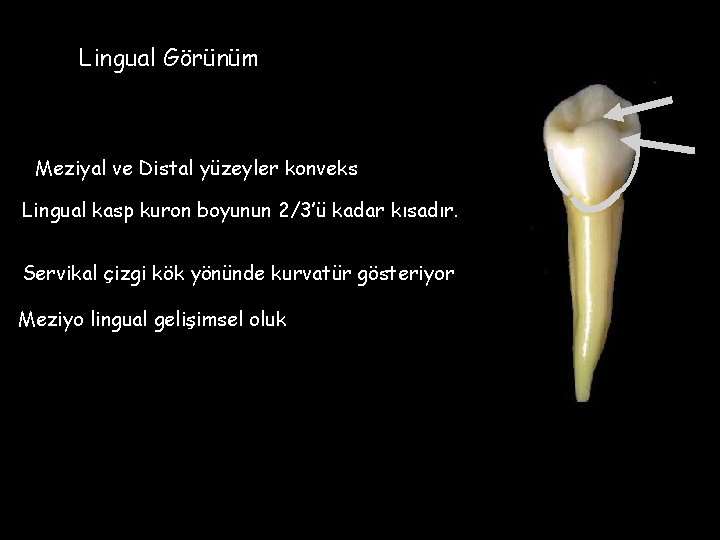Lingual Görünüm Meziyal ve Distal yüzeyler konveks Lingual kasp kuron boyunun 2/3’ü kadar kısadır.