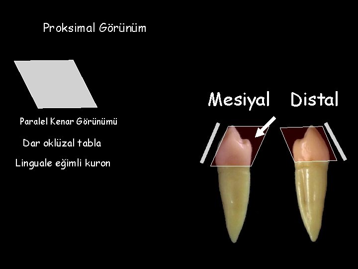 Proksimal Görünüm Mesiyal Paralel Kenar Görünümü Dar oklüzal tabla Linguale eğimli kuron Distal 