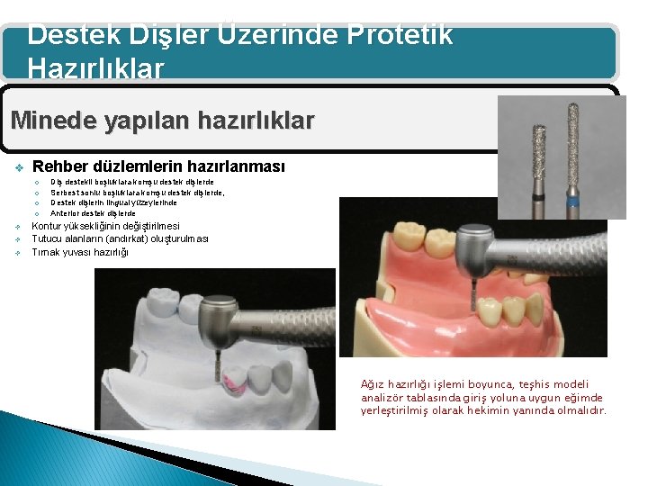 Destek Dişler Üzerinde Protetik Hazırlıklar Minede yapılan hazırlıklar v Rehber düzlemlerin hazırlanması o o