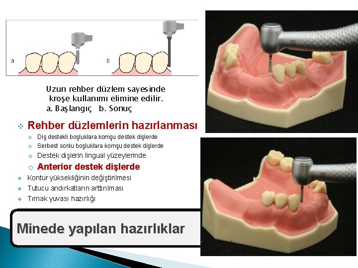 Uzun rehber düzlem sayesinde kroşe kullanımı elimine edilir. a. Başlangıç b. Sonuç v Rehber